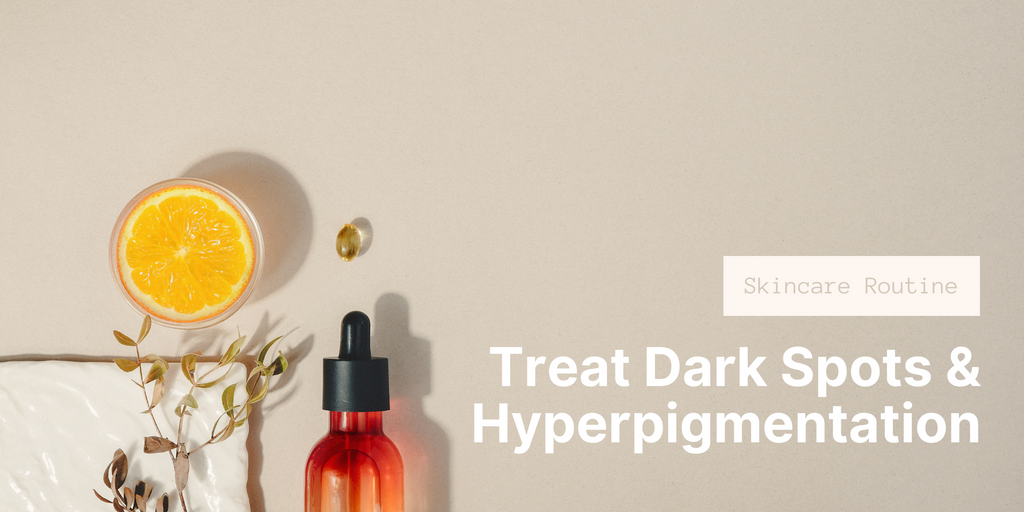 How to Treat Dark Spots & Hyperpigmentation?